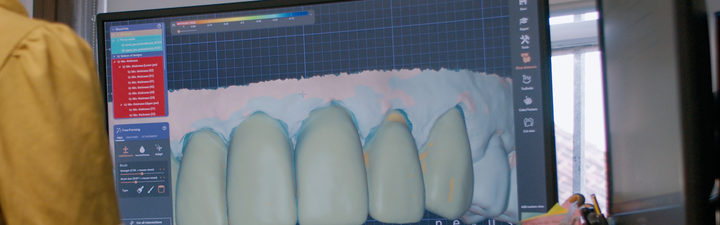Who we work with - Dental Labs – Elos Medtech